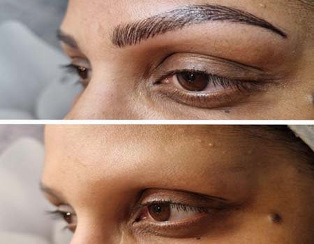 Best Hair Spa Kilpauk