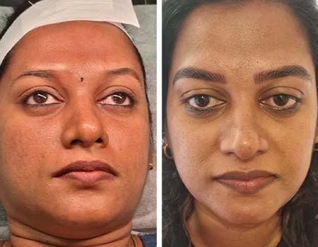 Bridal Makeup in Kilpauk